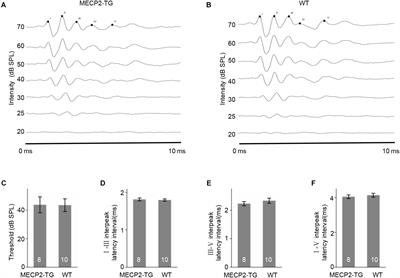 Atypical Response Properties of the Auditory Cortex of Awake MECP2-Overexpressing Mice